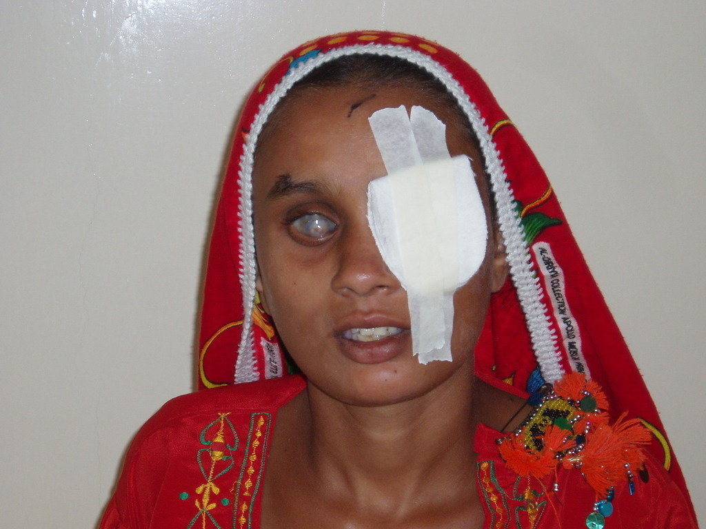 Reports on can give the Gift of Sight to a Blind Person ...