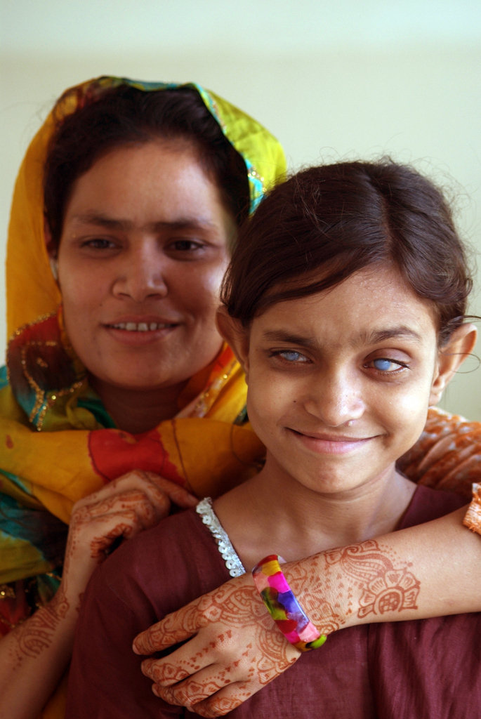 $28 can give the Gift of Sight to a Blind Person