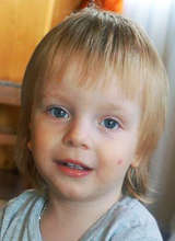 This two-year-old had hearing loss.