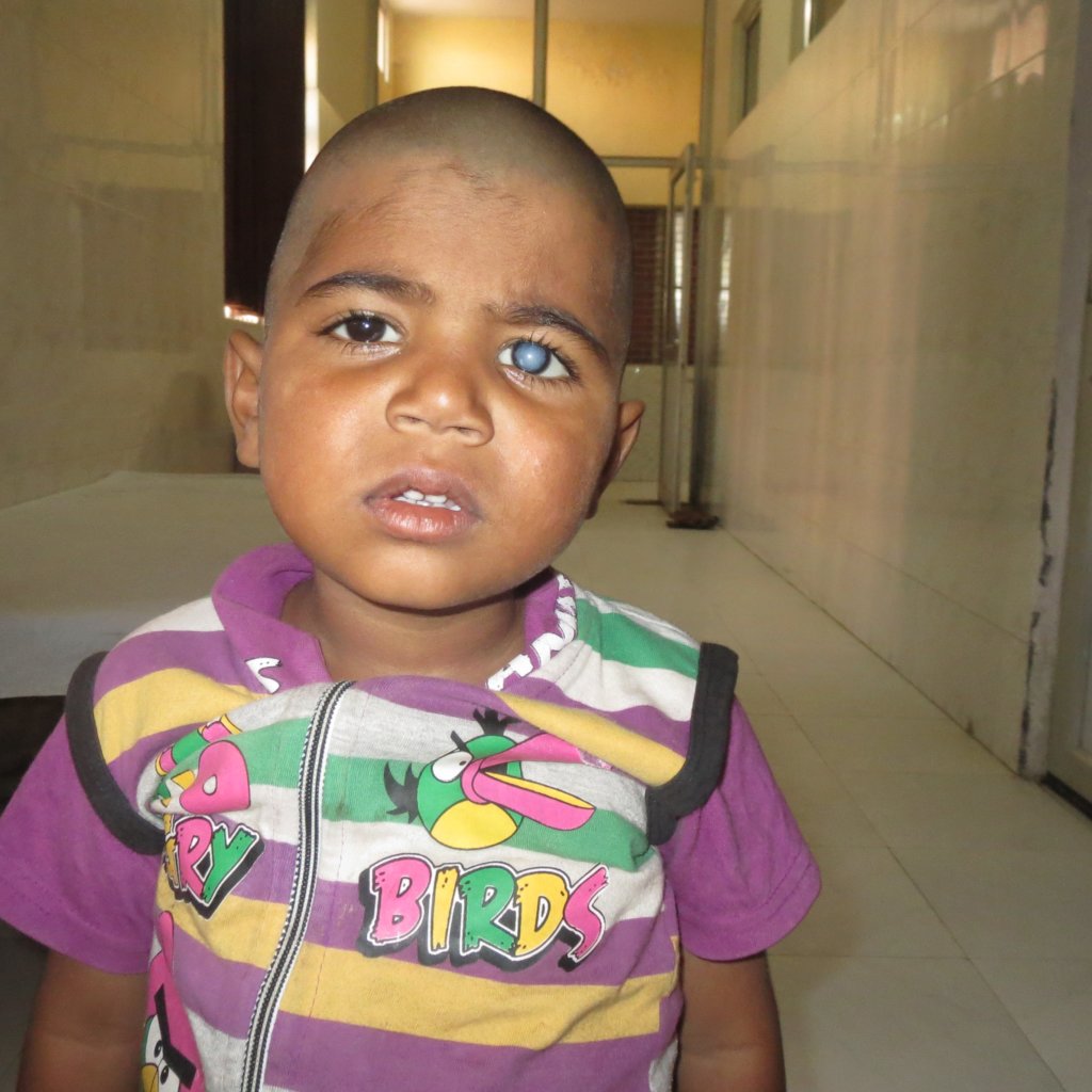 Eradicate the avoidable blindness