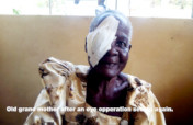 1000 Surgeries for the Poor of Kalangala:
