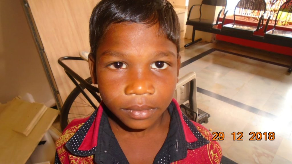 TRIEYE-  Tribal  children eye care