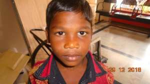 TRIEYE-  Tribal  children eye care