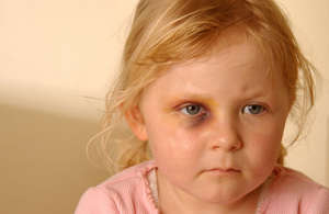 Child Abuse Knows No Boundaries