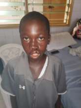 The swelling will diminish with time.