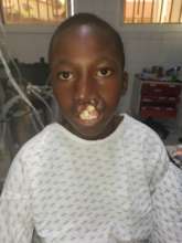 Hassan before surgery.