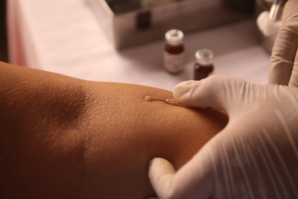 Support TB Elimination on Tam Hai Island, Viet Nam