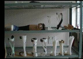 Artificial limb