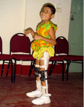 Rehabilitation of 50 Bangladeshi Disabled Children