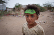 Give to starving families in Yemen