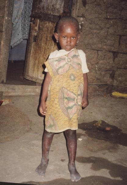 Rehabilitation of street children in Kenya