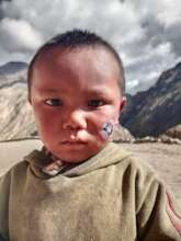 Child with facial issues