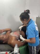 A severely burned man receives necessary care.