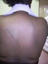 Marks still visible a week after the abuse