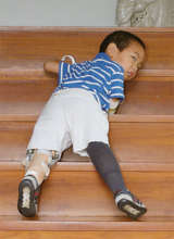 Movement Disability