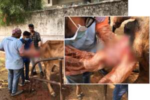 doctor is manually placing the prolapse position