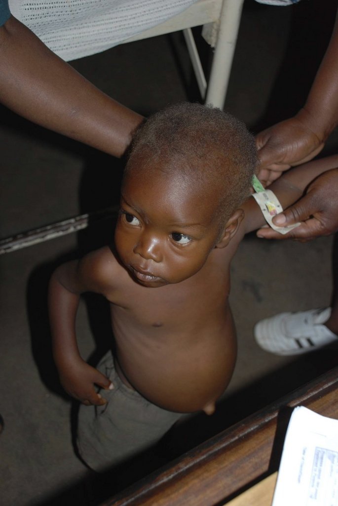Treat Children for Malnutrition in Tanzania