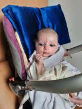 Amena- the brave girl visits FMIC for checkup