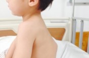 Help 50 Afghan Children Suffering from Spinal TB