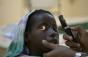 Conducting Outreach programme for cataract surgery