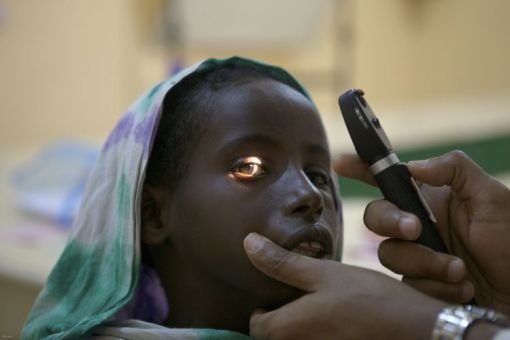 Conducting Outreach programme for cataract surgery