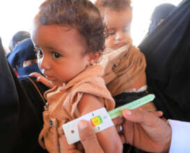 A child is screened for malnutrition.