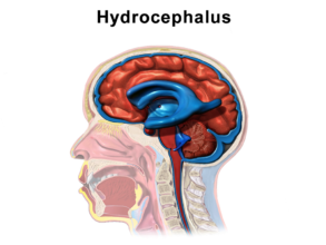 Ventricular system containing cerebrospinal fluid