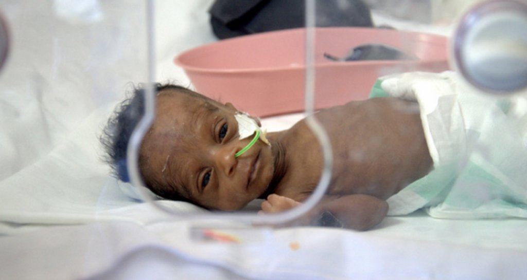 Screen 500 babies for congenital diseases in Ghana