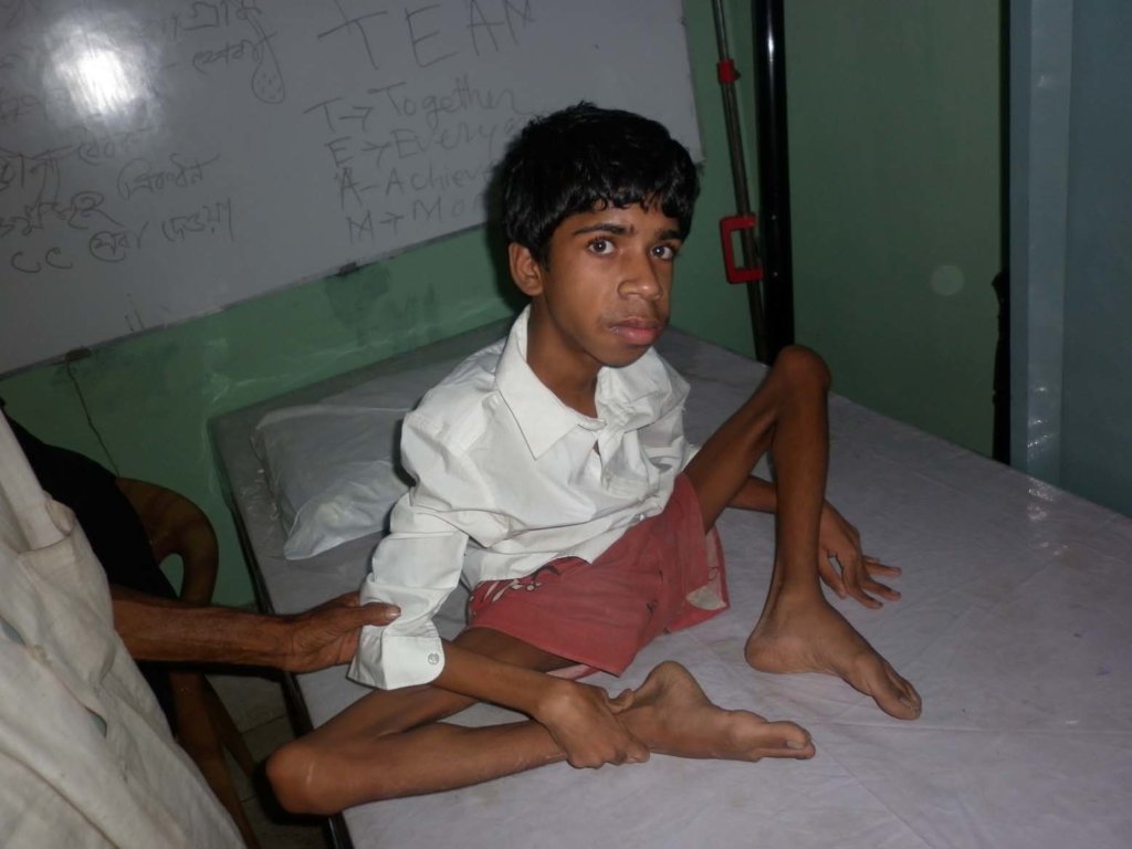 Provide Physical Therapy to CoastalBelt,Bangladesh