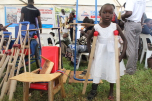 A girl with corrected club foot receives crutches