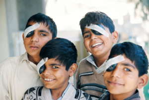 Four brothers with cataract