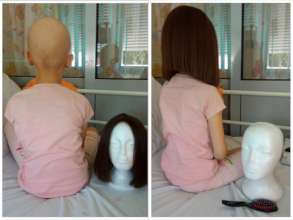 Wig donation - cancer patient