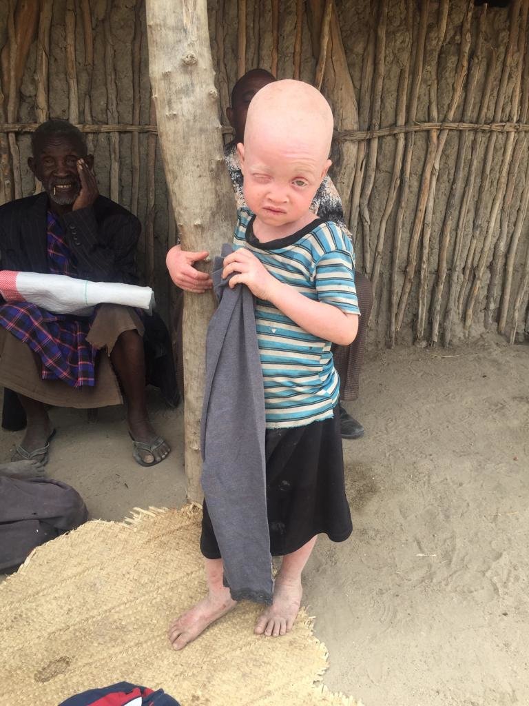 Most Vulnerable Children Education Access