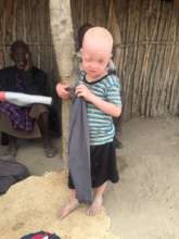 Children with disability