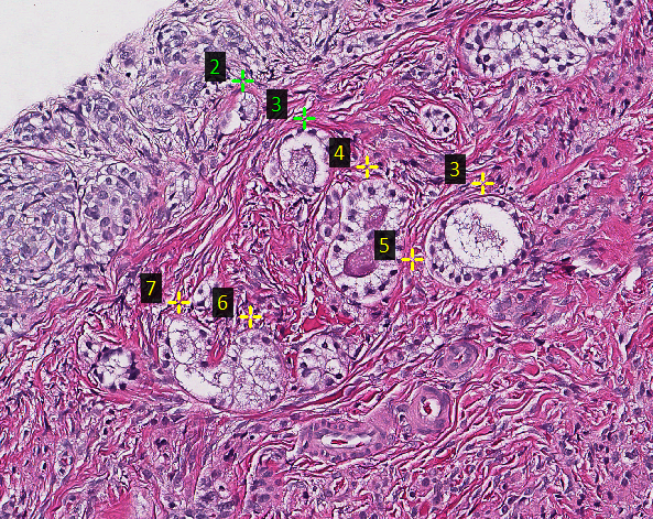 A treated dog ovary, in clinical trials by 600.