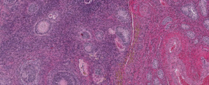 A control (untreated) ovary, in clinical trials.