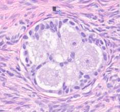 A disrupted canine ovary follicle after treatment.