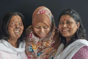 Hospital Care for 350 Acid Victims in Bangladesh