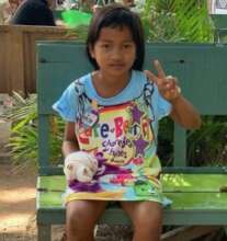child with burned hand