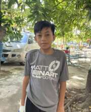 Vath post op