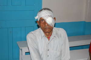 Elderly patients suffering from Cataract
