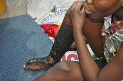 Care for the neglected