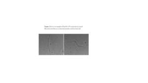 PepMV particles