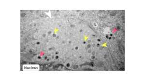 Vaccinia Virus Factory in the infected cell