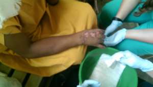 Injured Hand Receiving Follow Up Care