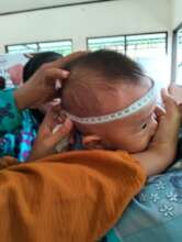 Checking baby's head to monitor brain development
