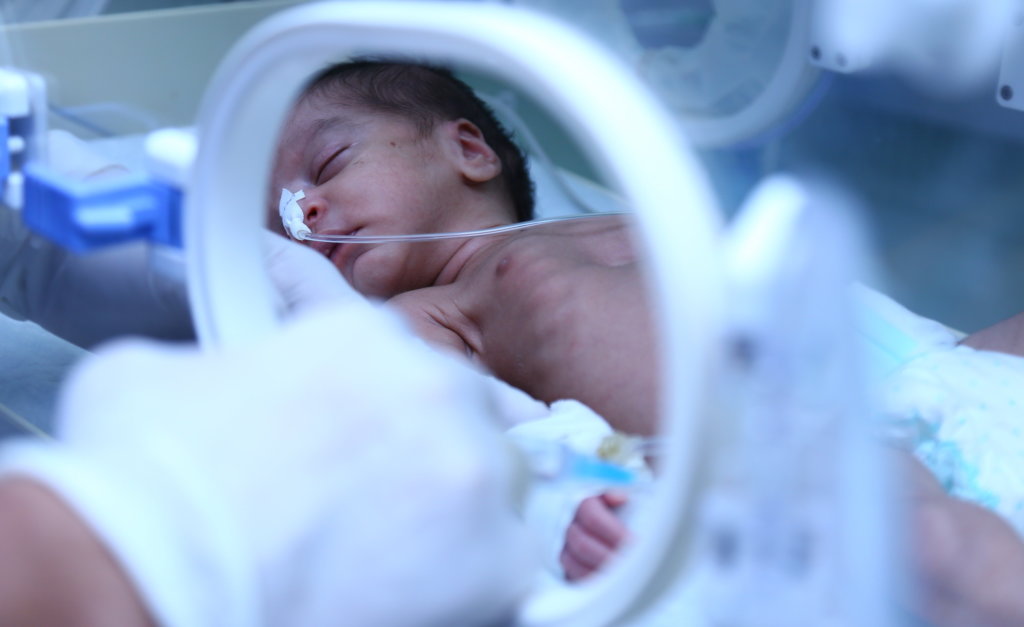 Life saving treatment of babies by Donations/Zakat