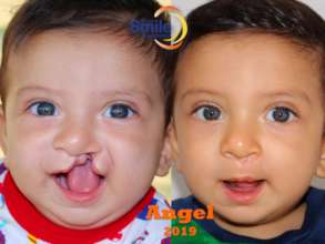 Angel's Healthy Smile