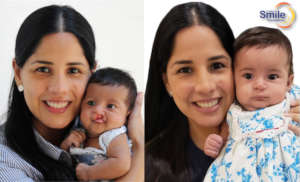 Angela's Healthy Smile