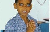 Gift of Sight for differently abled children